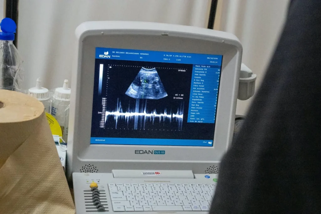 Monitor de ecografía utilizado durante el operativo de la Red Estratégica de Salud en Pampa del Indio