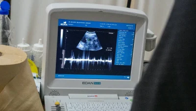 Monitor de ecografía utilizado durante el operativo de la Red Estratégica de Salud en Pampa del Indio