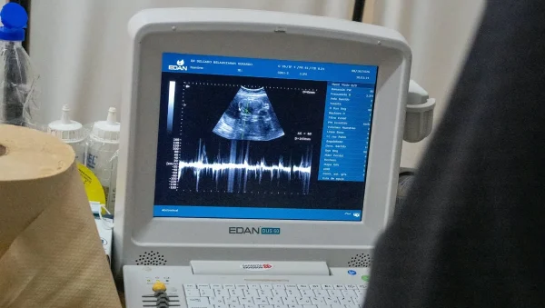 Monitor de ecografía utilizado durante el operativo de la Red Estratégica de Salud en Pampa del Indio
